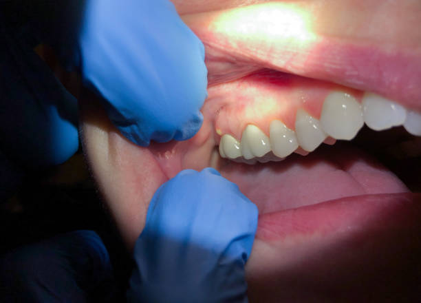Best Emergency Treatment for Toothache in South Les, AK